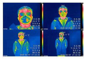 Infrared thermal image monitor-Rapid screening and alarm of abnormal body temperature
